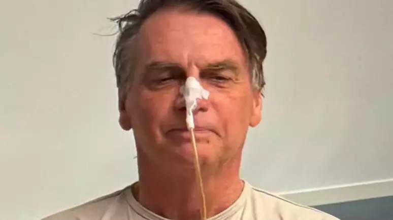 Estado de Saúde de Bolsonaro: Ex-presidente passa por novos exames e segue sob cuidados médicos